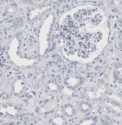 Cadherin-17 Antibody