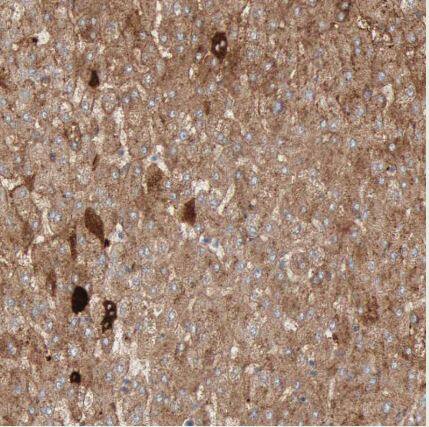C4 binding protein A Antibody