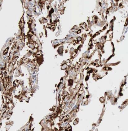 C4 binding protein A Antibody