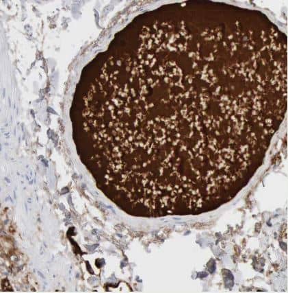 C4 binding protein A Antibody