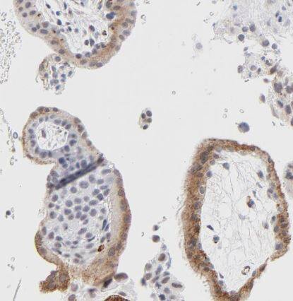 Latent TGF-beta bp2/LTBP-2 Antibody
