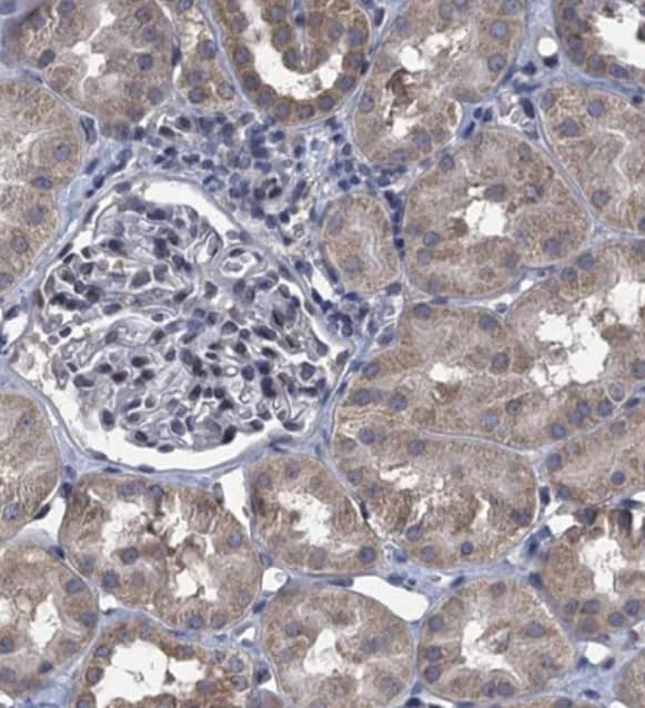 CTU2 Antibody - BSA Free