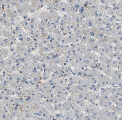 SUSD2 Antibody