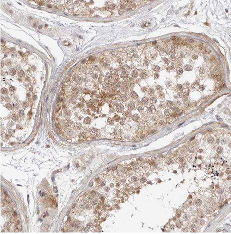 TRAPPC3 Antibody-INBP1-88664-IHC-P