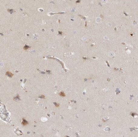 TRAPPC3 Antibody [NBP1-88664]