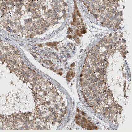 ARMC1 Antibody