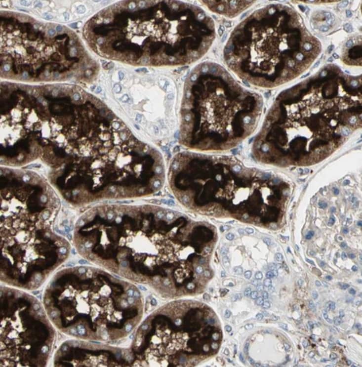 ATP6V1B2 Antibody - BSA Free