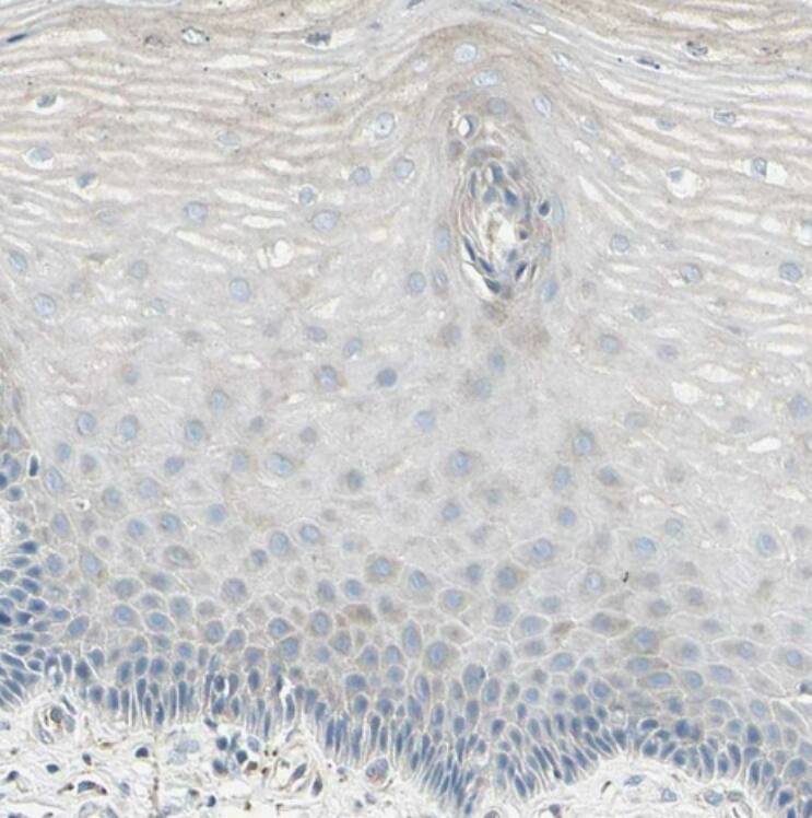 ATP6V1B2 Antibody - BSA Free