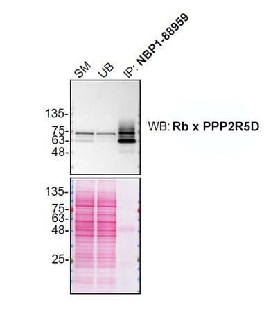 PPP2R5D Antibody