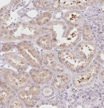 LRRC23 Antibody - BSA Free
