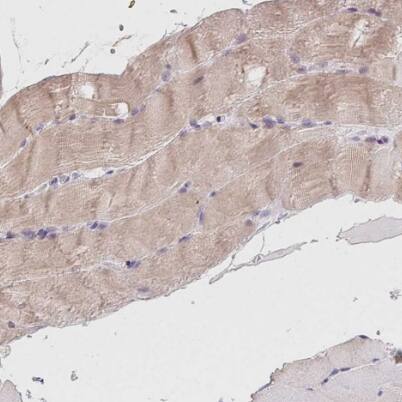 LRRC23 Antibody - BSA Free