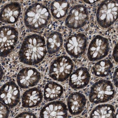 B7-H3/CD276 Antibody