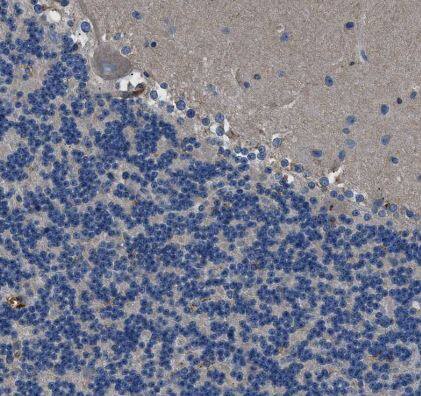 B7-H3/CD276 Antibody