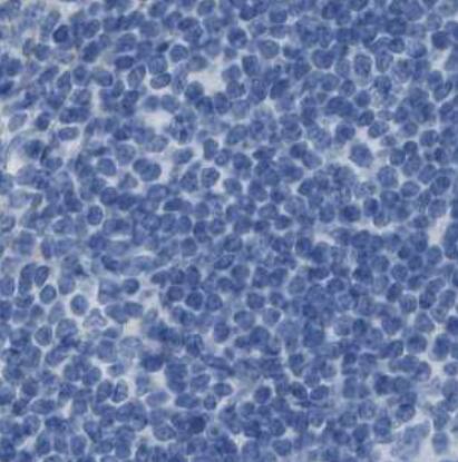 Apolipoprotein L1 Antibody - BSA Free