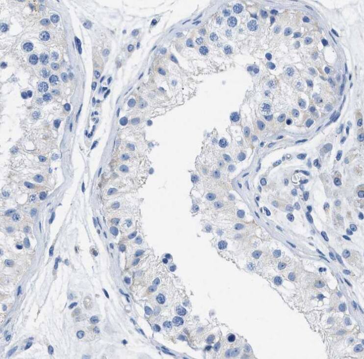 Apolipoprotein L1 Antibody - BSA Free