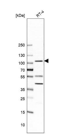 E6AP/UBE3A Antibody