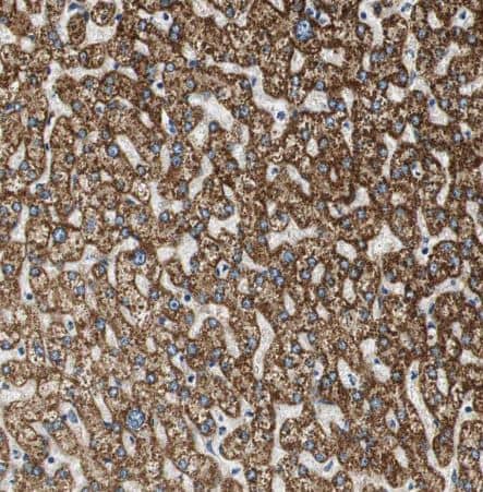 ALDH4A1 Antibody