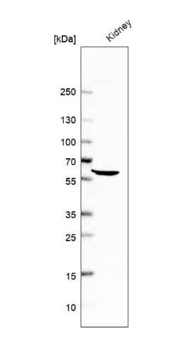 ALDH4A1 Antibody