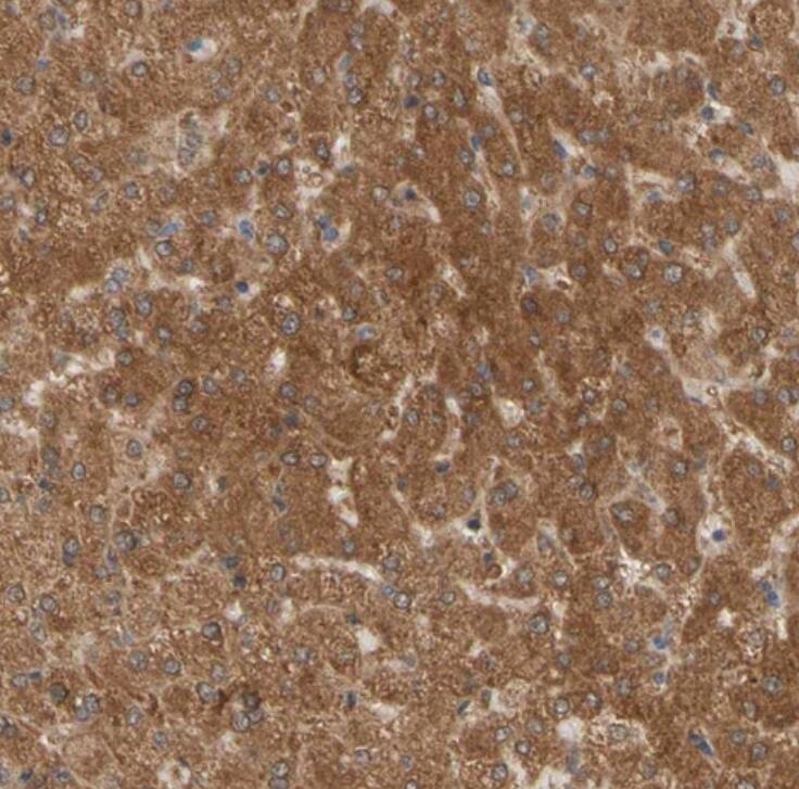 ALDH9A1 Antibody - BSA Free