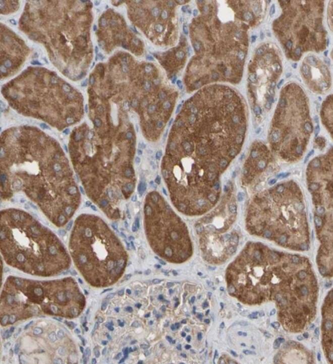 ALDH9A1 Antibody - BSA Free