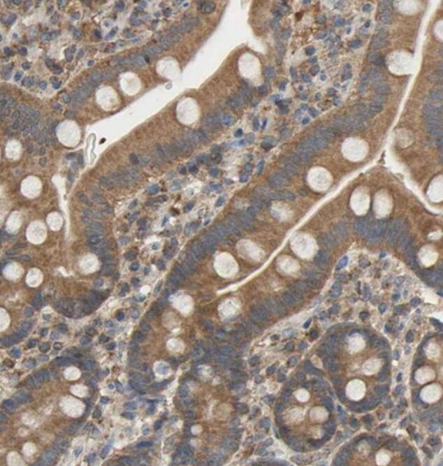 ALDH9A1 Antibody - BSA Free