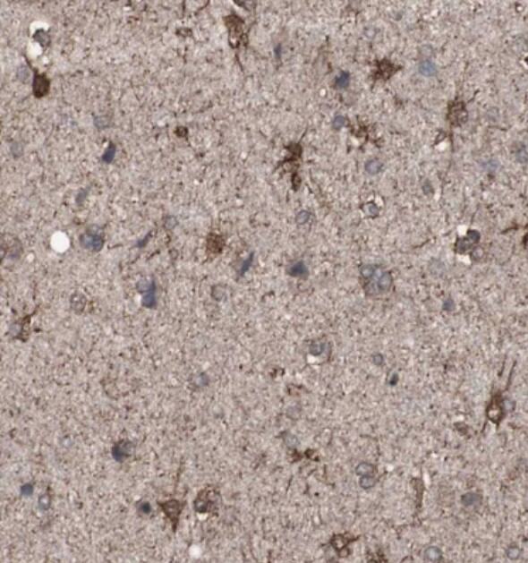 ALDH9A1 Antibody - BSA Free