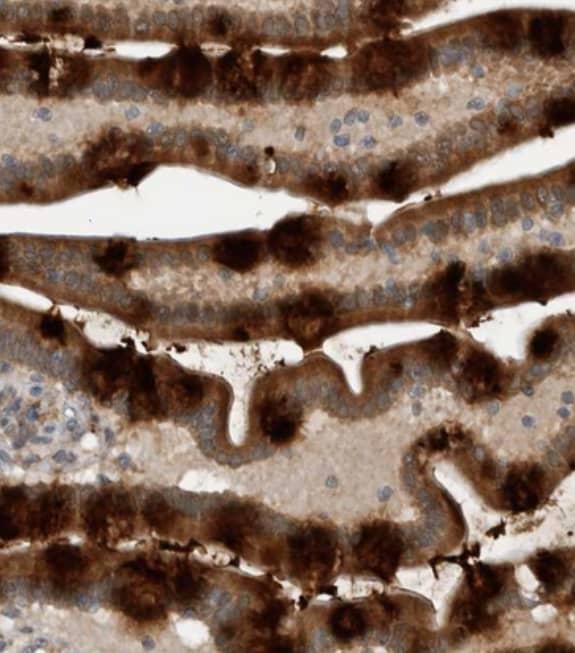 GBA2 Antibody - BSA Free