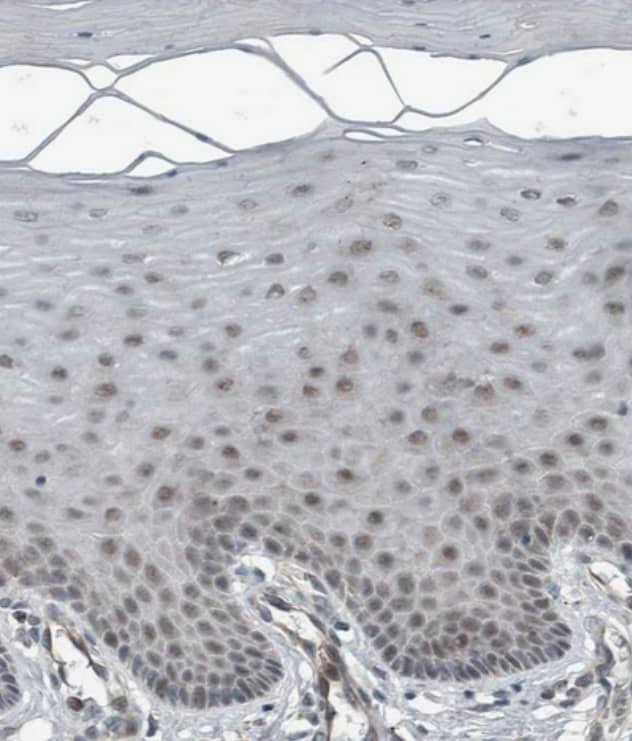 GBA2 Antibody - BSA Free