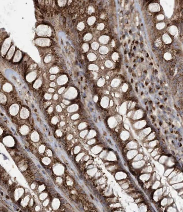 TRAF3IP2 Antibody - BSA Free