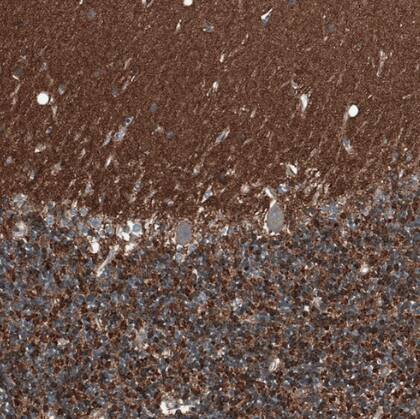 SCD5 Antibody - BSA Free