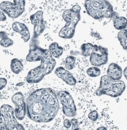 SCD5 Antibody - BSA Free