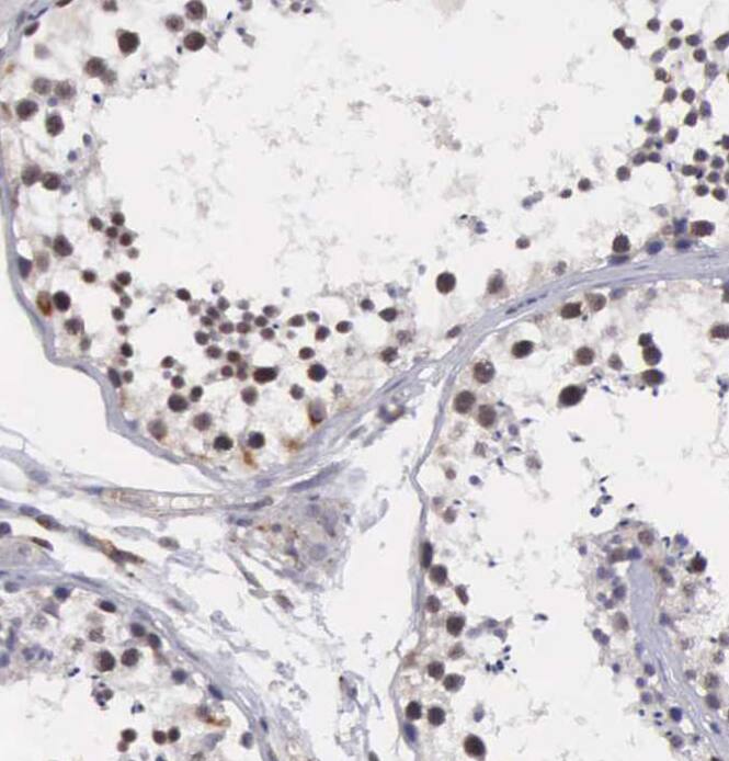 MORC2 Antibody - BSA Free