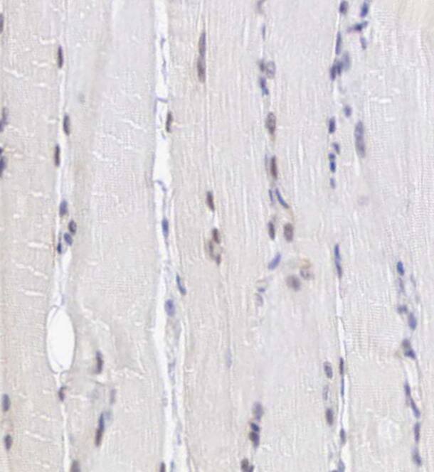 MORC2 Antibody - BSA Free