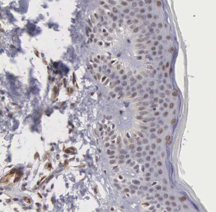 MORC2 Antibody - BSA Free