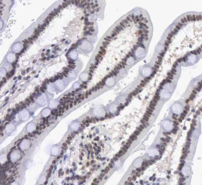 MORC2 Antibody - BSA Free