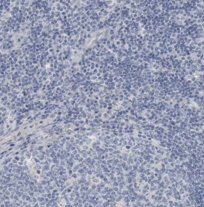 ABHD12 Antibody - BSA Free