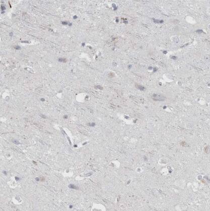 ABHD12 Antibody - BSA Free