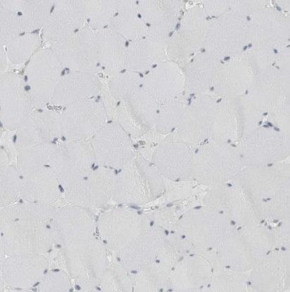 ABHD12 Antibody - BSA Free