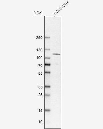 AARS2 Antibody