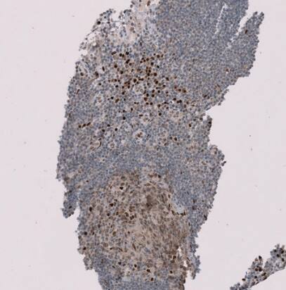 RMI2 Antibody - BSA Free