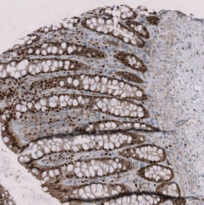 RMI2 Antibody - BSA Free