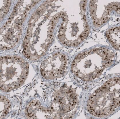 RMI2 Antibody - BSA Free