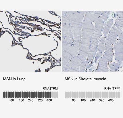 Moesin Antibody