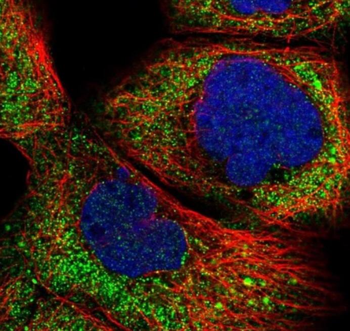 R3HCC1 Antibody - BSA Free
