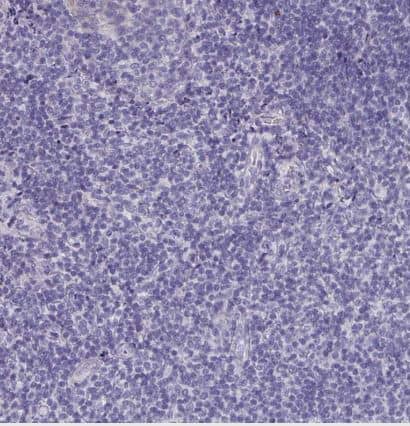 CFAP74 Antibody