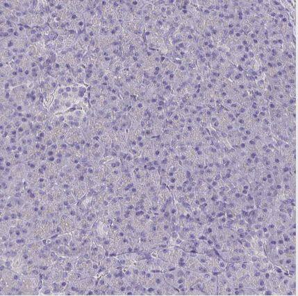 CFAP74 Antibody