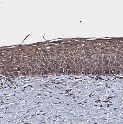 RAB12 Antibody - BSA Free