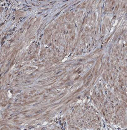 RAB12 Antibody - BSA Free