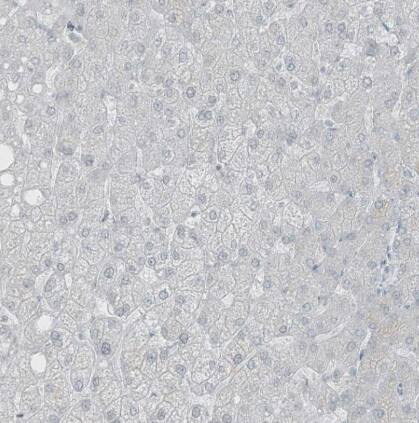 PRDM6 Antibody