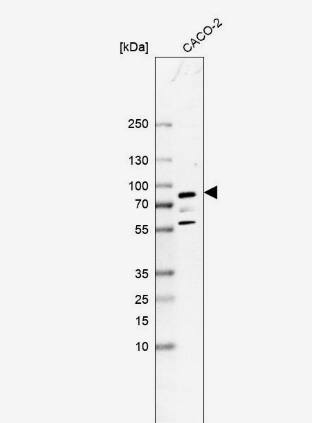Glycogen synthase 2 Antibody